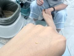 -世龙世家灰指甲·甲沟炎·跖疣护理·修脚(东江湾路店)