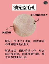 -蕾特恩专业祛痘·皮肤管理