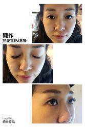 睫毛嫁接-光SPA科技美肤