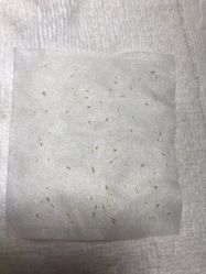 -苑苑vbeauty科技美容SPA