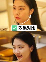 -广州健丽·去眼袋医疗美容机构