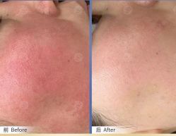 -美肤盾祛痘·问题肌头疗管理中心