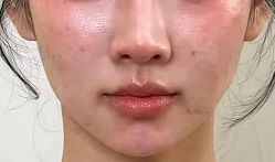 -天津健丽·去眼袋医疗美容机构