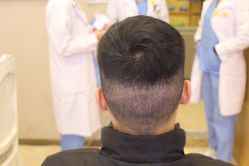 -大麦微针植发丨全国连锁