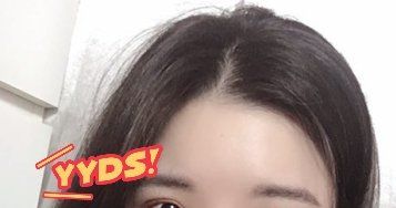 -大麦微针植发丨全国连锁