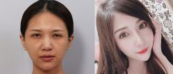 -SKINIST丽铂医疗美容