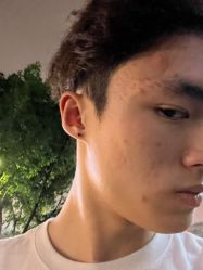 -花师傅专业手穿耳洞打耳洞穿孔