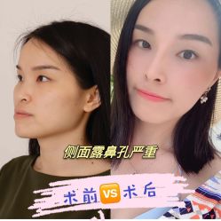 -广东韩妃整形外科医院