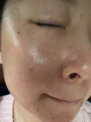 体验后-顾泽医疗美容