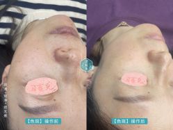 -清疣美疣·痣·斑净肤中心