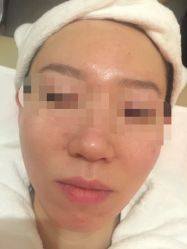 -皇族养心堂·净痘·修敏·御颜