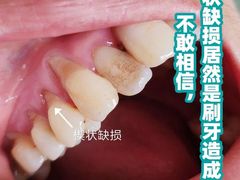 -团圆口腔·种植中心(锦江院区)