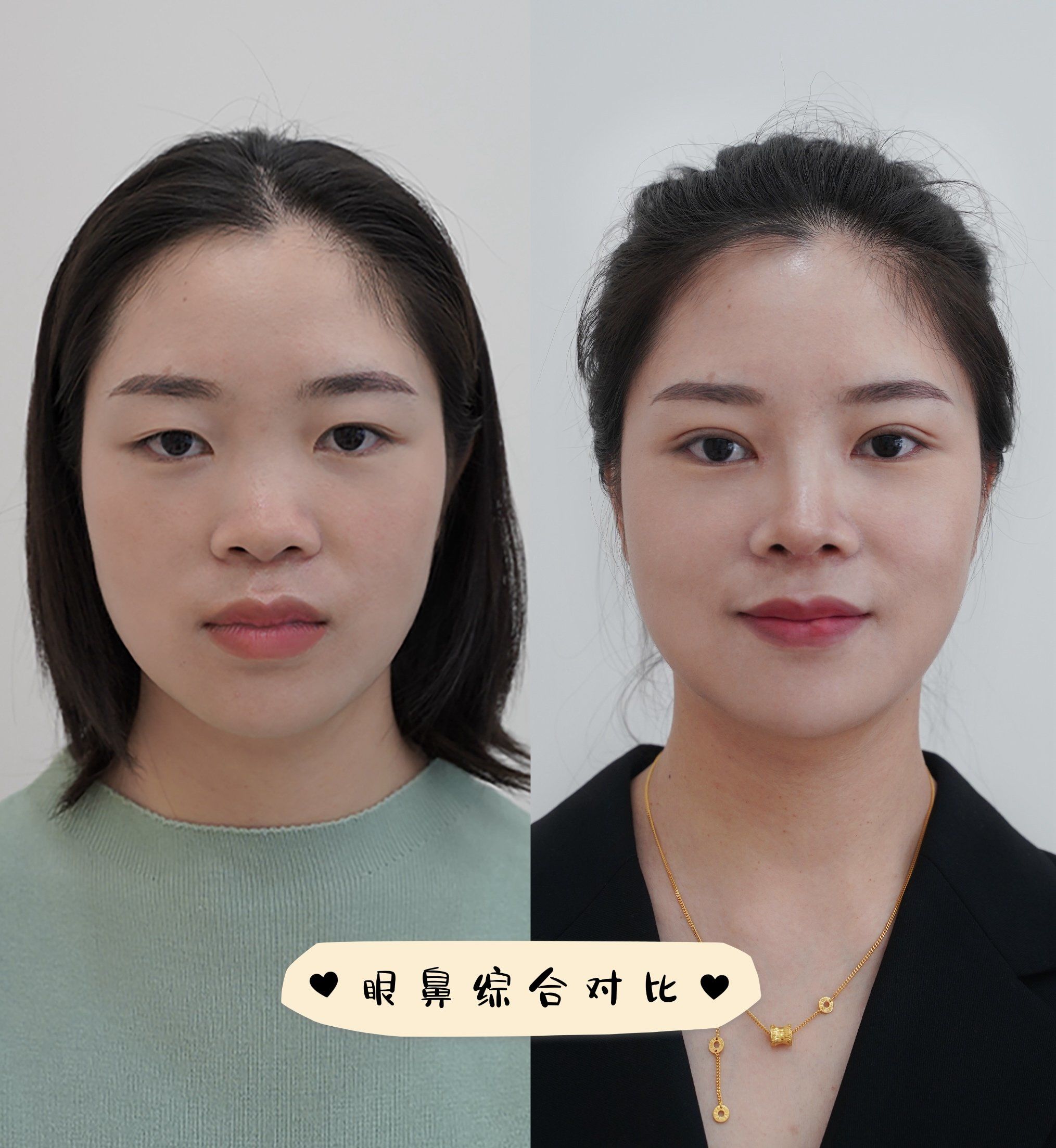 好直观…果然鼻子决定颜值下限!