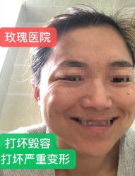 -上海玫瑰医疗美容医院