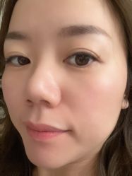 体验后-深圳鹏爱悦心医疗美容医院