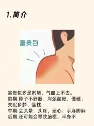 -克丽缇娜