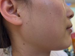 -长沙雅美医疗美容医院