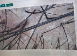 -雍禾植发