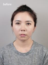-Yestar艺星医疗美容医院
