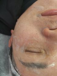 -长沙雅美医疗美容医院