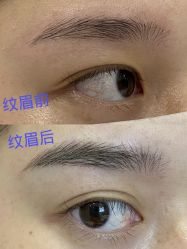 -成都艾特他整形外科医院