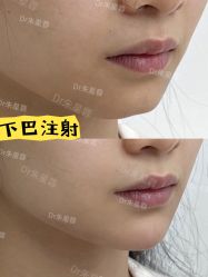 -Yestar重庆艺星医疗美容医院