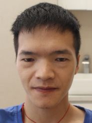 -大麦微针植发全国连锁