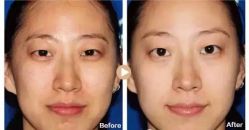 -SKINIST丽铂医疗美容