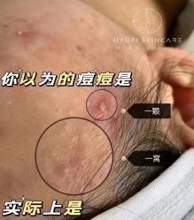 -MLP美丽派·问题肌疗愈中心