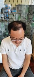 点击看大图 -极客侠男士假发定制补发