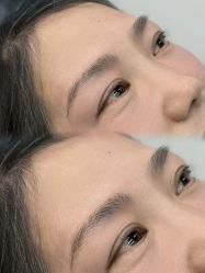 点击看大图 -张小野·专业半永久纹眉