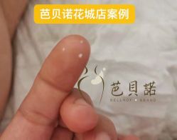 点击看大图 -芭贝诺产后修复(石芽岭花城店)