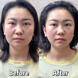 -颜和骨正·明哲式骨相美学整骨