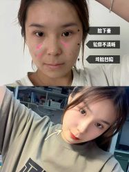 -上海伊莱美医疗美容医院