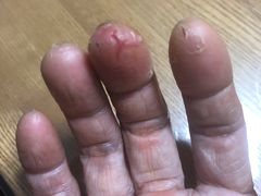 -深圳安仁堂中医·推拿按摩·肩颈调理