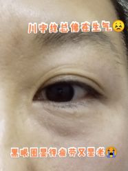 体验前-JS医疗美容