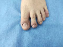 -世龙世家甲沟炎·灰指甲·嵌甲矫正·修脚(武侯区双楠店)