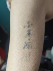 -净肤洗纹身