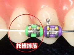 -团圆口腔·种植中心(锦江院区)