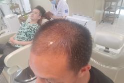 -大麦微针植发丨全国连锁