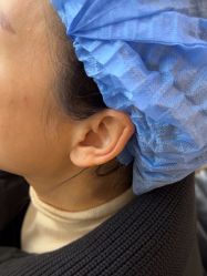 -四川米兰柏羽医学美容医院