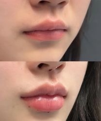 -上海伊莱美医疗美容医院