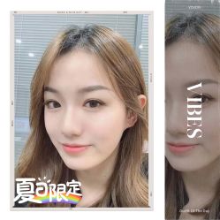 -大麦微针植发全国连锁