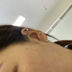 点击看大图 -痘庄专业袪痘皮肤管理连锁
