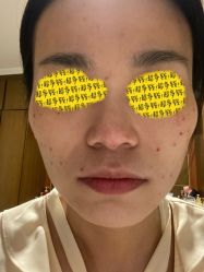 -More摩尔医美の注射线雕光电中心