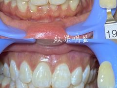 -精德口腔·种植修复·儿牙中心(财富中心店)