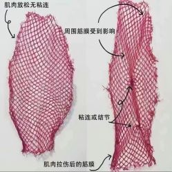 -Fundi张玉珊修身堂·indiba·BTL科技瘦身