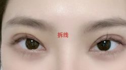 -素美医疗美容·西南眼鼻整形·修复基地