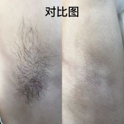 -植蔻妍倍儿专业脱毛·皮肤管理
