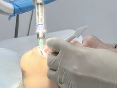 -美酷口腔牙齿矫正(江桥万达店)